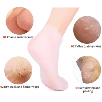 2шт Увлажняющие гелевые носки с защитой от растрескивания, Силиконовые носки для ухода за ногами, средство для удаления омертвевшей кожи, Обезболивающие инструменты для педикюра